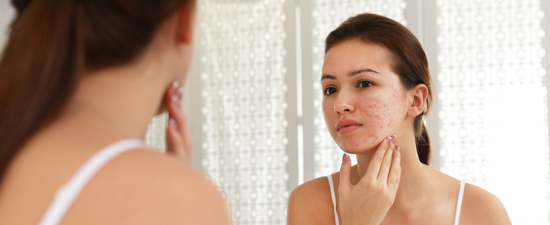 What are the Most Common Skin Conditions?